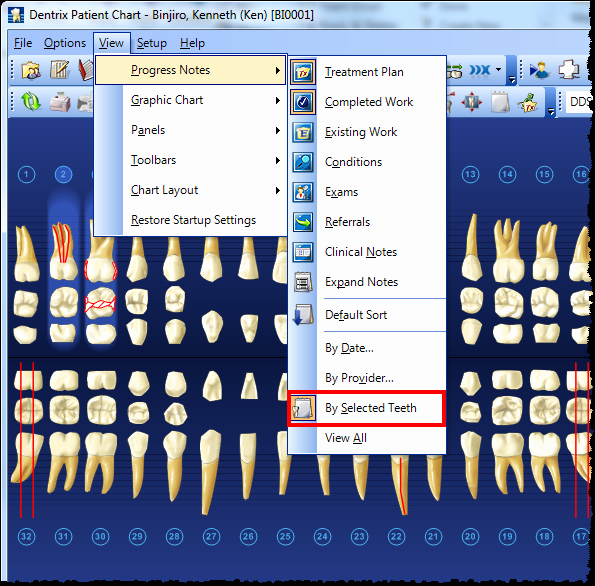 Dental Progress Notes Template Unique Dentrix Tip Tuesdays Viewing by Selected Teeth In the